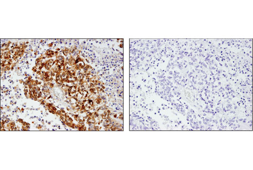 Immunohistochemistry Image 3: Phospho-YAP (Ser127) (D9W2I) Rabbit mAb (BSA and Azide Free)