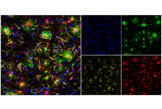 Immunofluorescence Image 1: APP/β-Amyloid (NAB228) Mouse mAb (BSA and Azide Free)