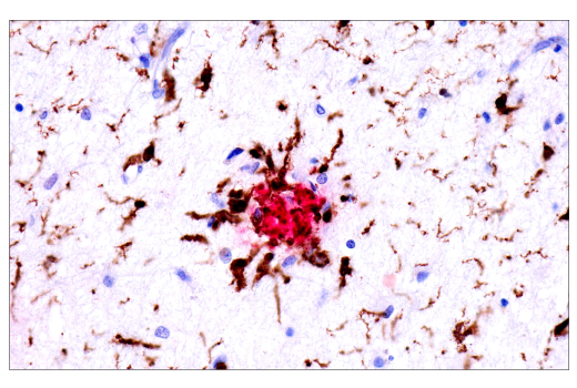 Immunohistochemistry Image 1: APP/β-Amyloid (NAB228) Mouse mAb (BSA and Azide Free)