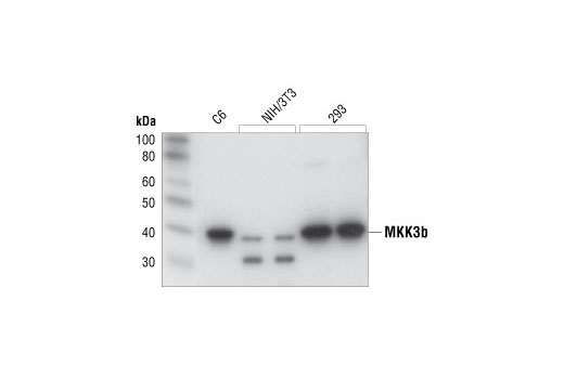 Western Blotting Image 1: MKK3b Antibody