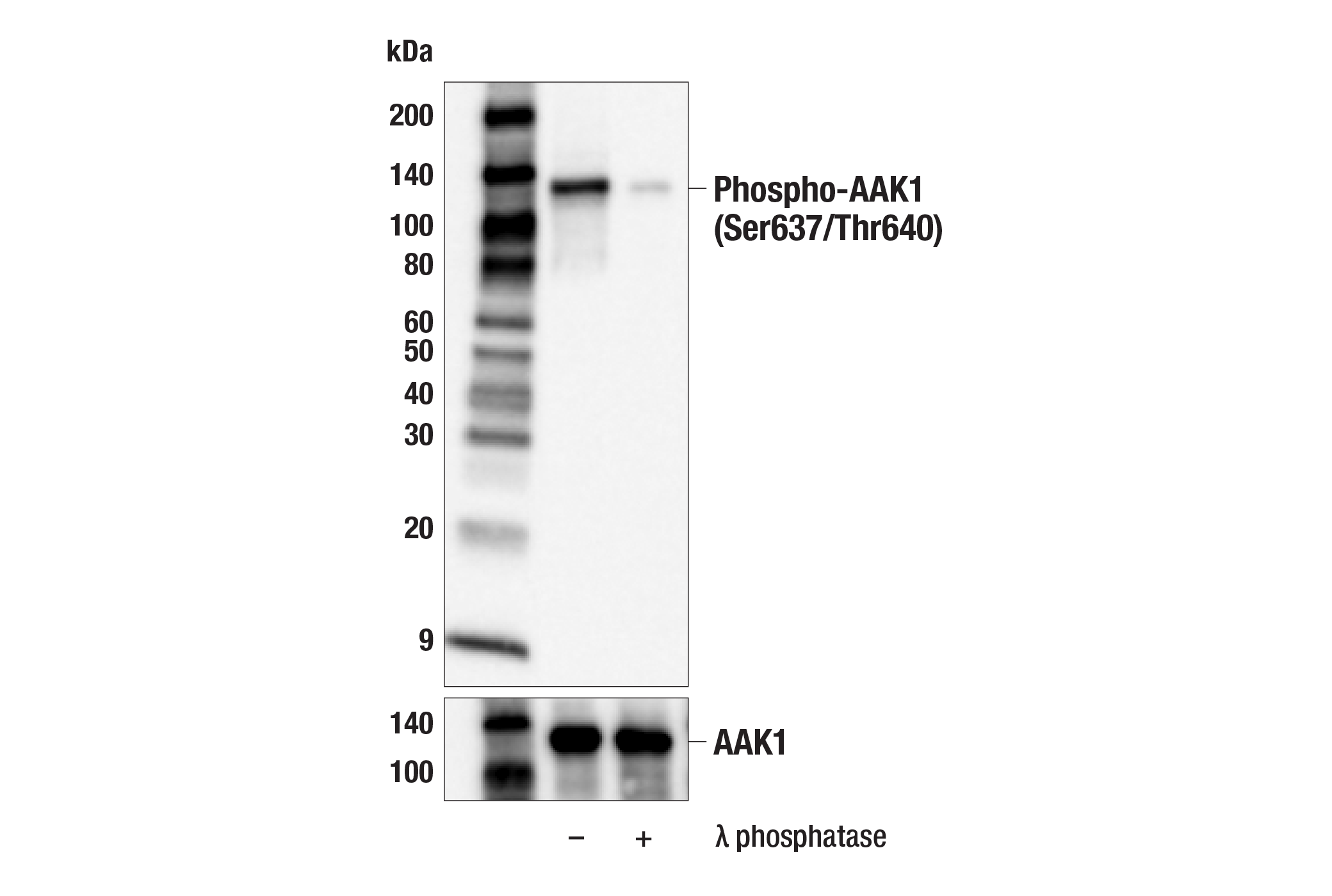 Western Blotting Image 1: Phospho-AAK1 (Ser637/Thr640) Antibody