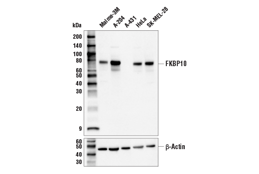 Western Blotting Image 1: FKBP10 Antibody