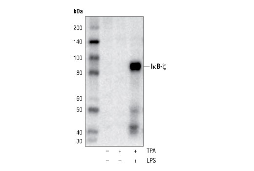 Western Blotting Image 1: IκB-ζ Antibody