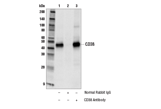 Immunoprecipitation Image 1: CD38 Antibody