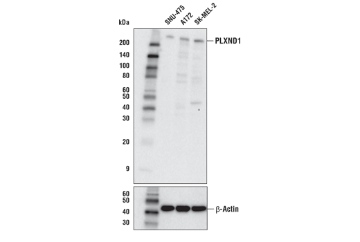 Western Blotting Image 1: PLXND1 Antibody