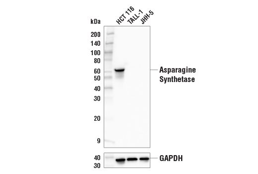 Western Blotting Image 2: Asparagine Synthetase (E6C2C) XP® Rabbit mAb