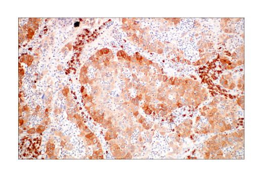 Immunohistochemistry Image 1: Asparagine Synthetase (E6C2C) XP® Rabbit mAb