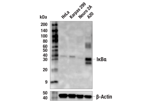 Western Blotting Image 3: IκBα (112B2) Mouse mAb (Carboxy-terminal Antigen)