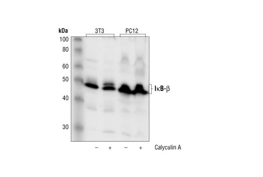 IkB Beta Antibody | Cell Signaling Technology