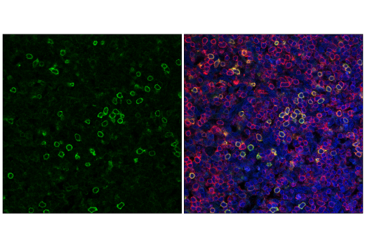 Immunofluorescence Image 1: NK1.1/CD161 (E6Y9G) Rabbit mAb (Alexa Fluor® 488 Conjugate)