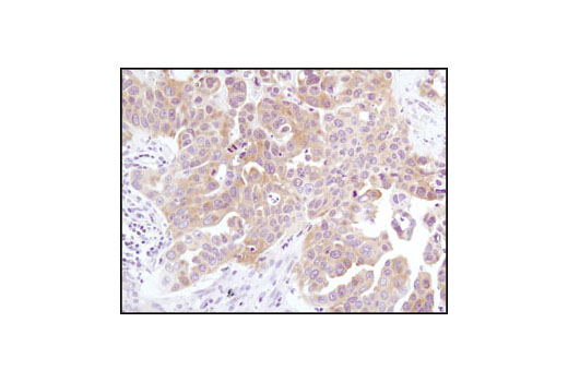 Immunohistochemistry Image 1: Phospho-Akt (Thr308) (244F9H2) Rabbit mAb (IHC Specific)