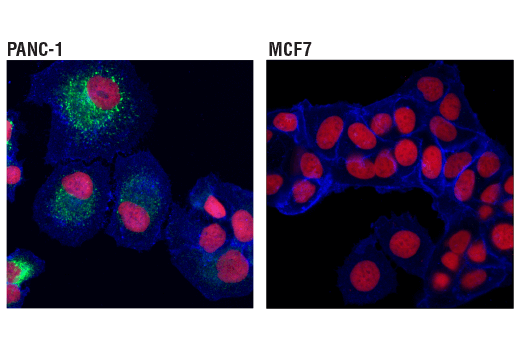 Immunofluorescence Image 1: CTGF (D8Z8U) Rabbit mAb (BSA and Azide Free)