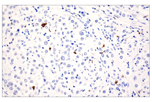 Immunohistochemistry Image 8: CD20 (E7B7T) XP® Rabbit mAb (BSA and Azide Free)