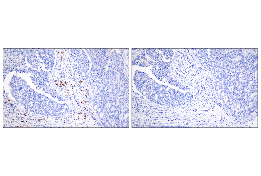 Immunohistochemistry Image 10: CD20 (E7B7T) XP® Rabbit mAb (BSA and Azide Free)