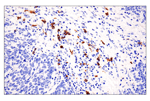 Immunohistochemistry Image 4: CD20 (E7B7T) XP® Rabbit mAb (BSA and Azide Free)