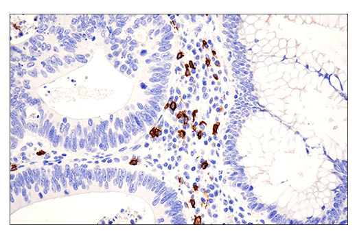Immunohistochemistry Image 1: CD20 (E7B7T) XP® Rabbit mAb (BSA and Azide Free)