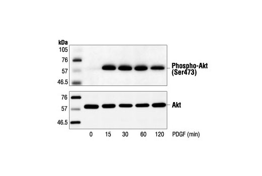Western Blotting Image 2: Phospho-Akt (Ser473) Antibody