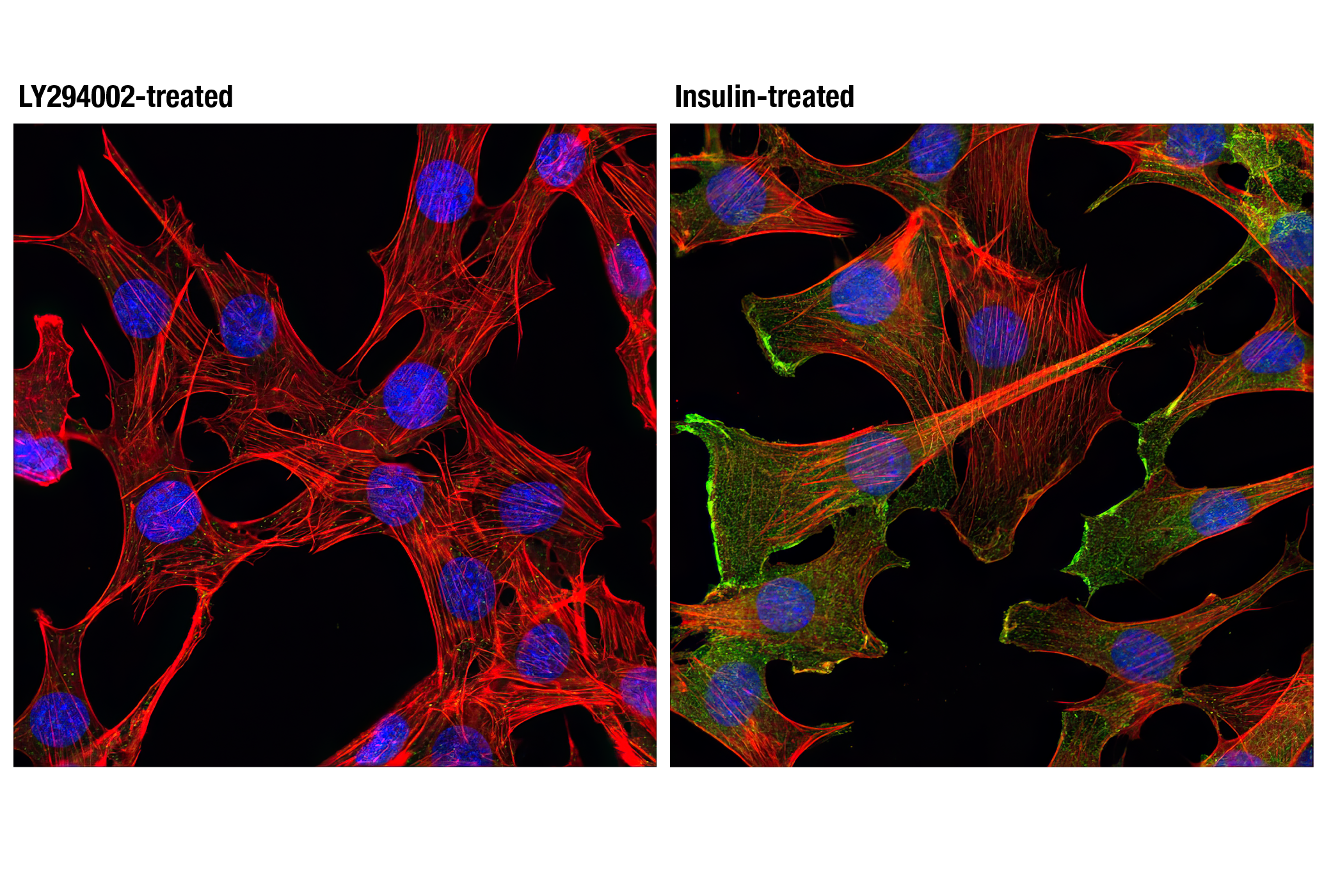Immunofluorescence Image 1: Phospho-Akt (Ser473) Antibody