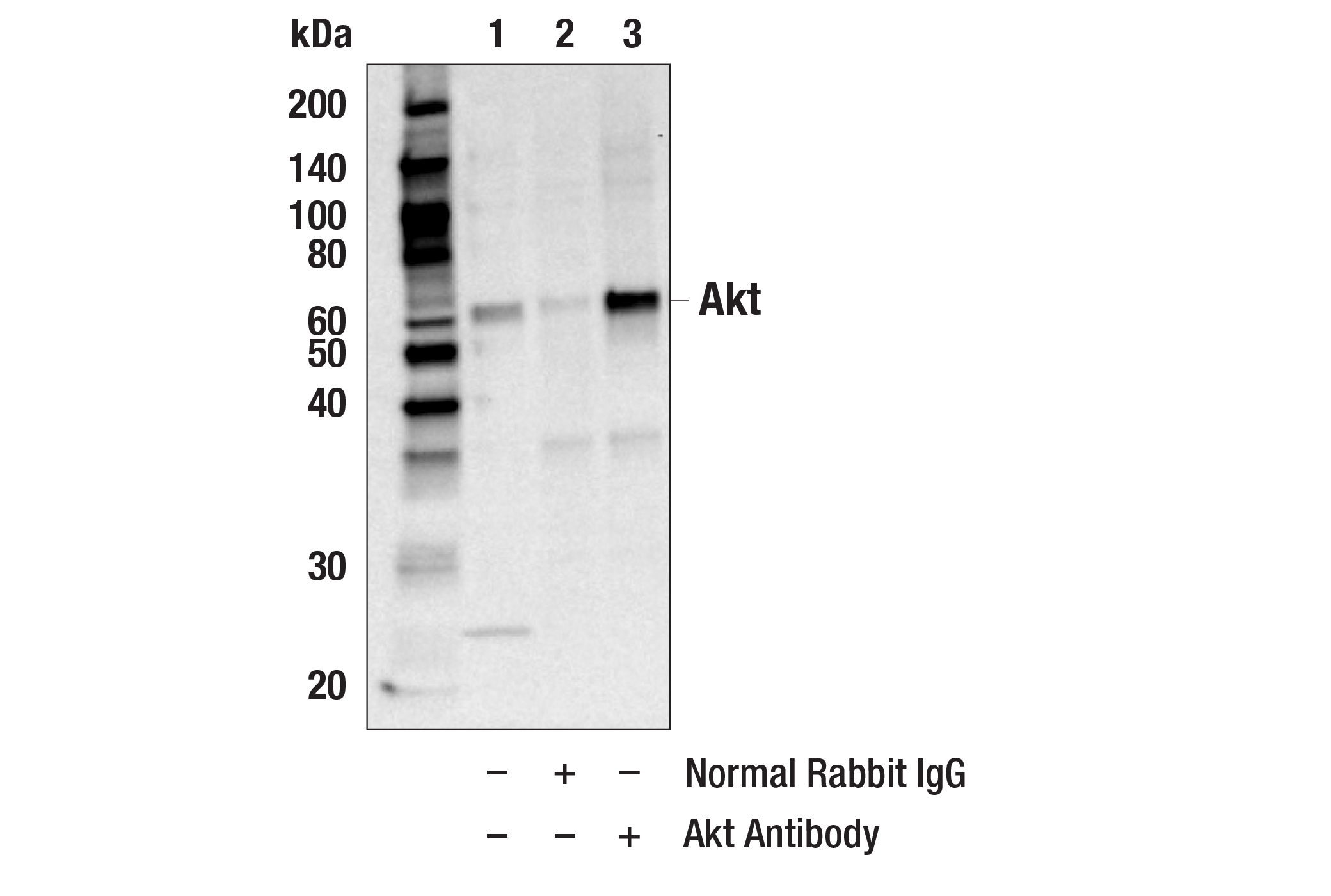 Immunoprecipitation Image 1: Akt Antibody