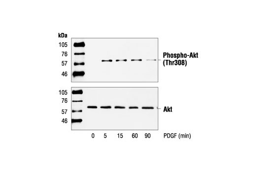 Western Blotting Image 1: Phospho-Akt (Thr308) Antibody