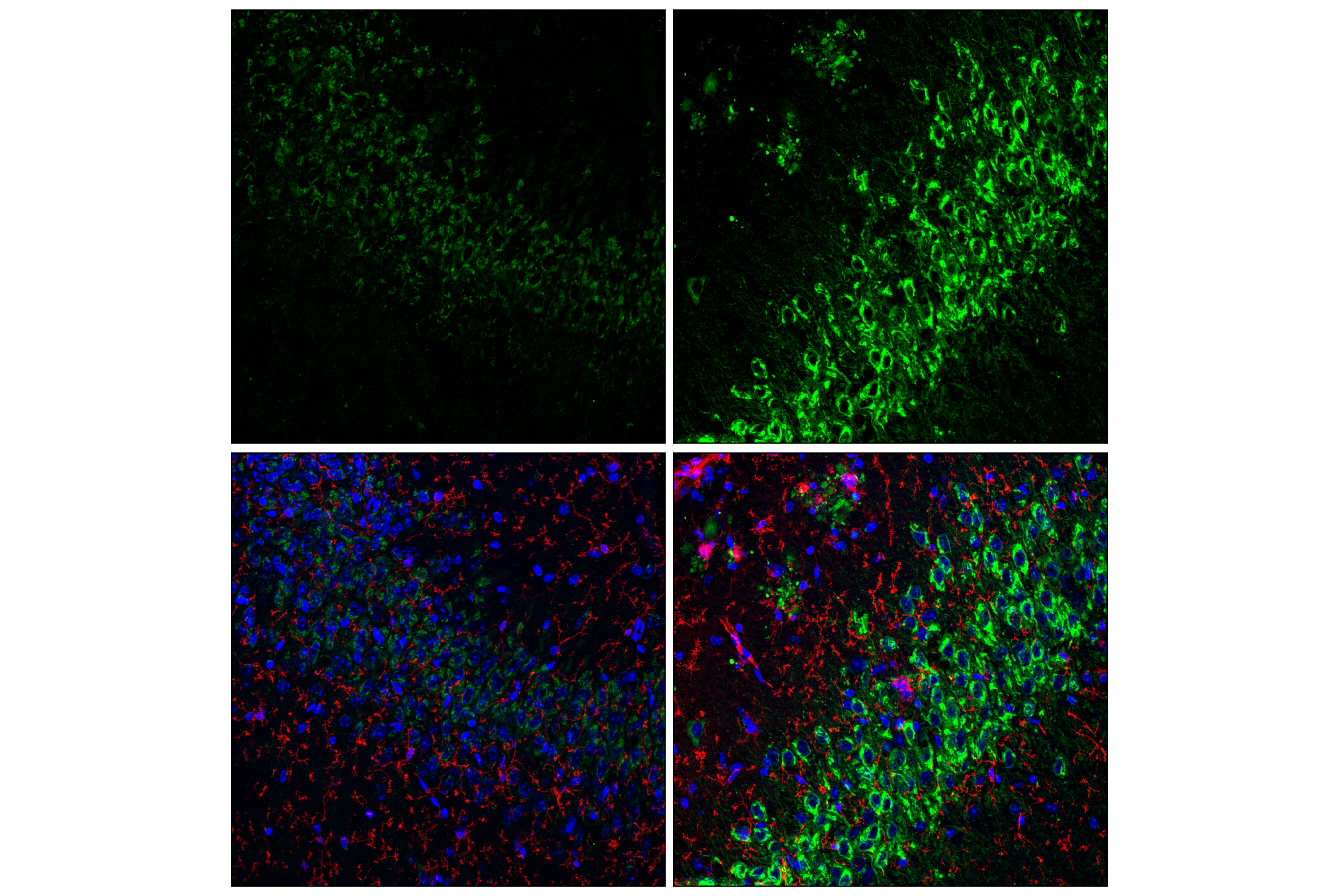 Immunofluorescence Image 1: APP (E3F3P) Rabbit mAb (BSA and Azide Free)