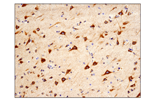 Immunohistochemistry Image 3: APP (E3F3P) Rabbit mAb (BSA and Azide Free)