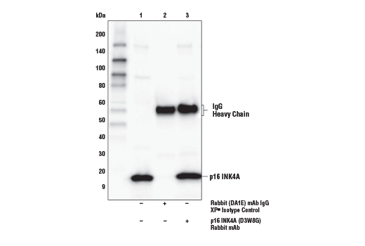  Image 18: Senescence Marker Antibody Sampler Kit