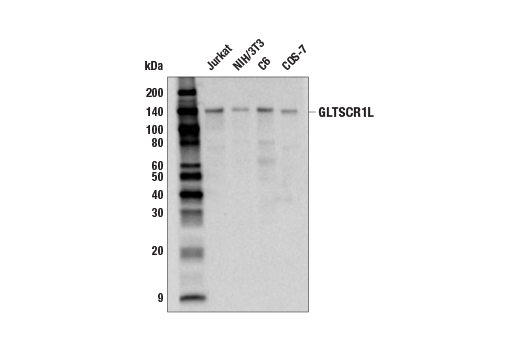 Western Blotting Image 1: GLTSCR1L (E9K6F) Rabbit mAb