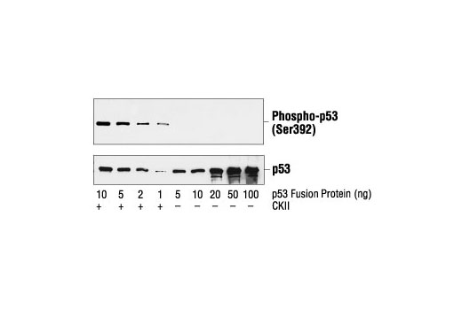  Image 5: Phospho-p53 Antibody Sampler Kit