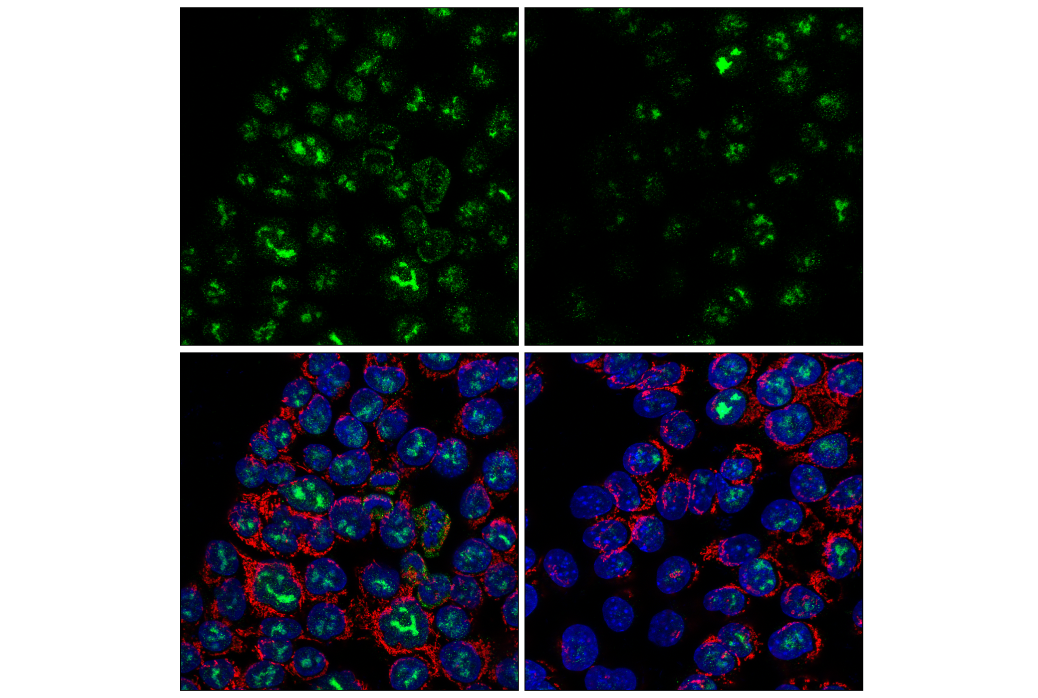 Immunofluorescence Image 3: NPM1 (E7W4P) Rabbit mAb
