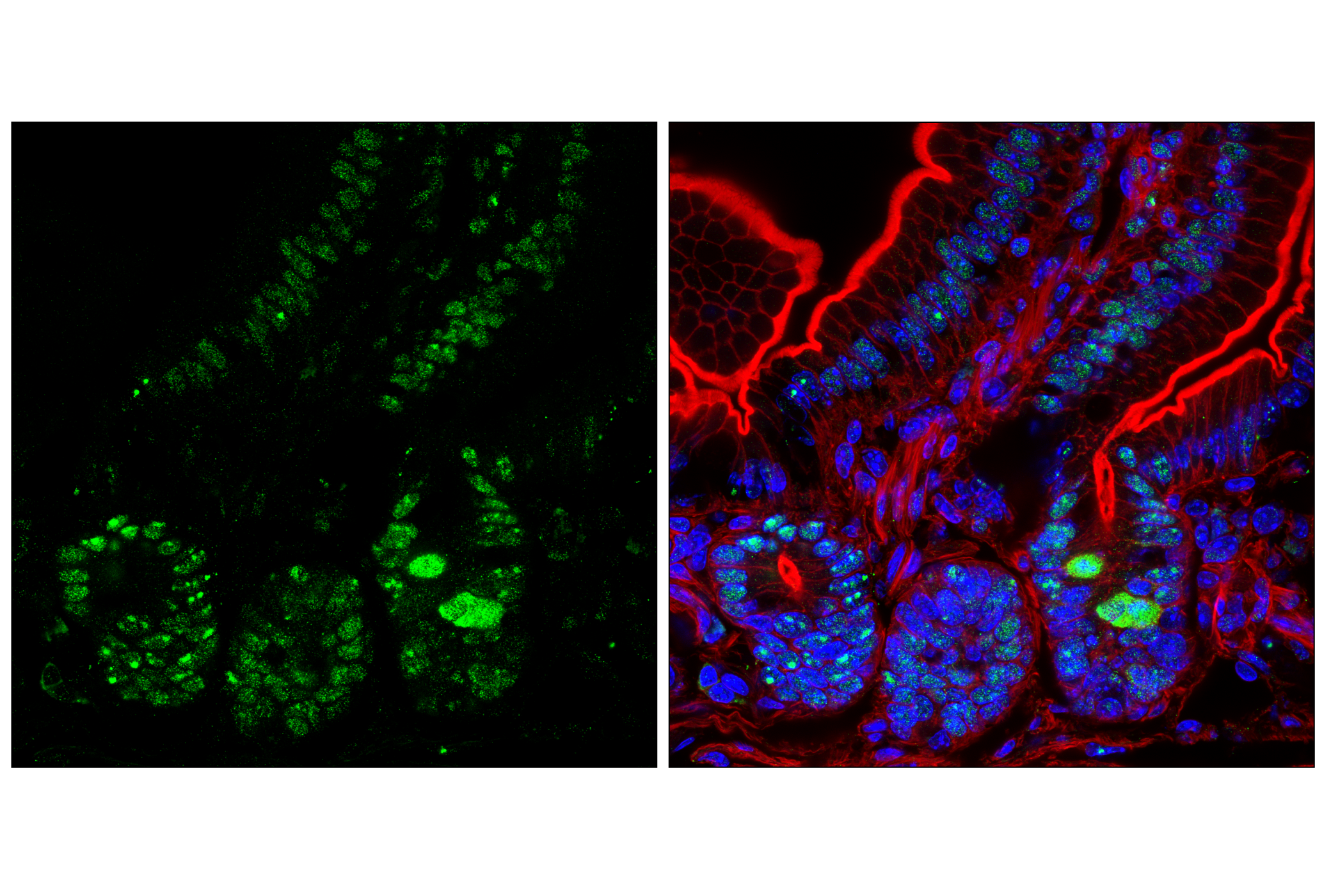 Immunofluorescence Image 2: NPM1 (E7W4P) Rabbit mAb