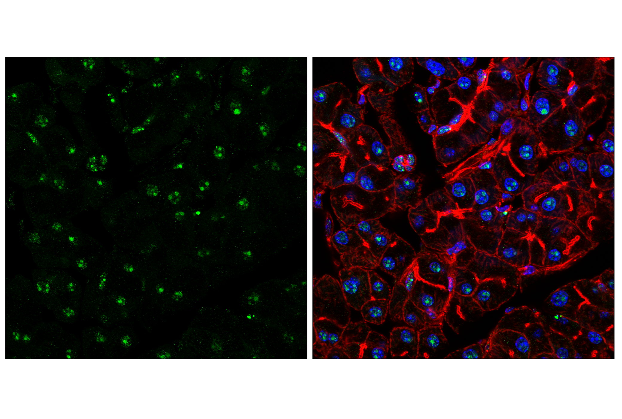 Immunofluorescence Image 1: NPM1 (E7W4P) Rabbit mAb