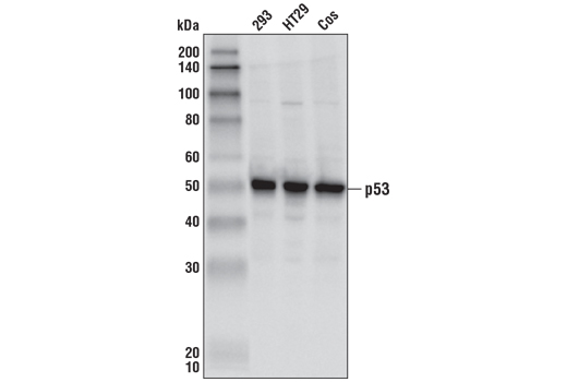 Western Blotting Image 1: p53 Antibody