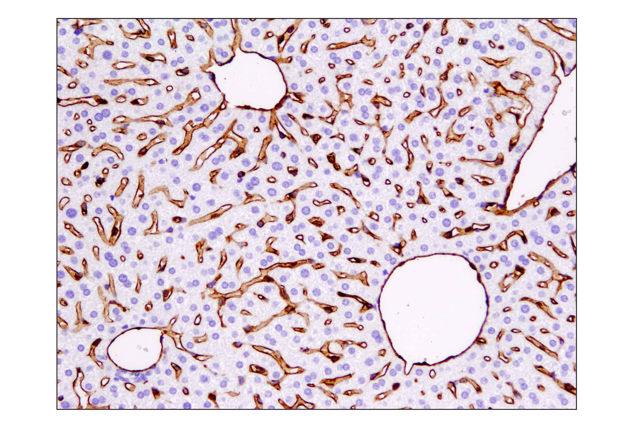 Immunohistochemistry Image 3: CD31 (PECAM-1) (D8V9E) XP® Rabbit mAb (BSA and Azide Free)
