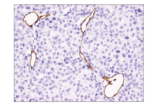 Immunohistochemistry Image 4: CD31 (PECAM-1) (D8V9E) XP® Rabbit mAb (BSA and Azide Free)