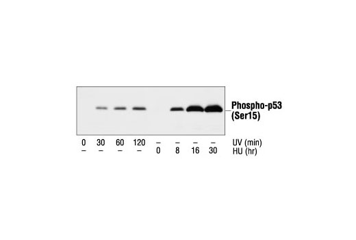  Image 8: p53 Antibody Sampler Kit