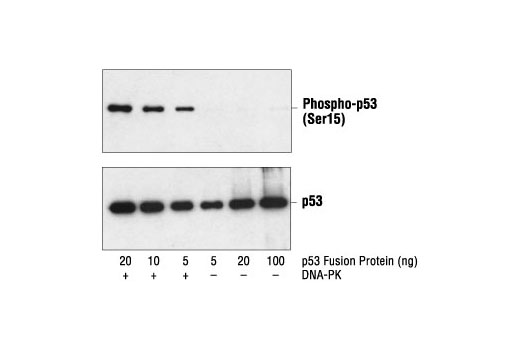 Western Blotting Image 1: Phospho-p53 (Ser15) Antibody