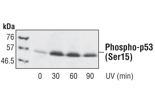 Western Blotting Image 2: Phospho-p53 (Ser15) Antibody
