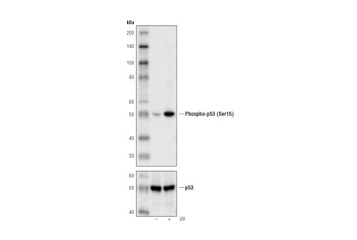 Western Blotting Image 1: Phospho-p53 (Ser15) (16G8) Mouse mAb
