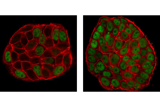 Immunofluorescence Image 1: Phospho-p53 (Ser15) (16G8) Mouse mAb
