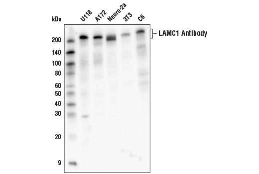 Western Blotting Image 1: LAMC1 Antibody