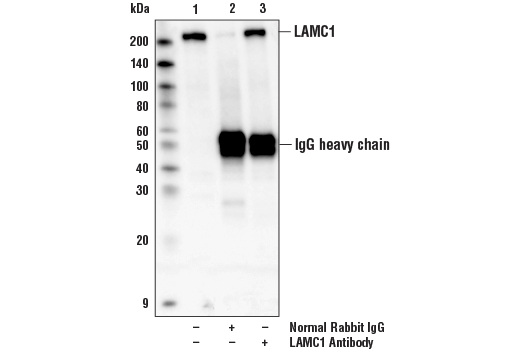 Immunoprecipitation Image 1: LAMC1 Antibody