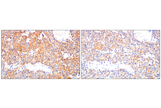 Immunohistochemistry Image 5: GUCY2C (E6I2U) Rabbit mAb (BSA and Azide Free)