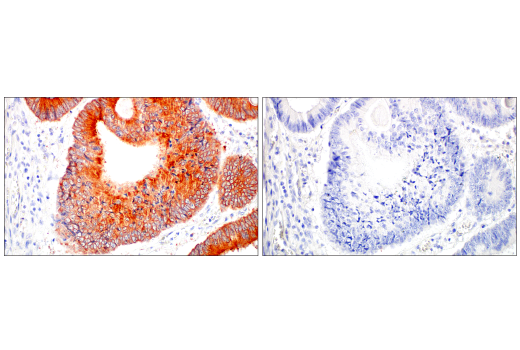 Immunohistochemistry Image 6: GUCY2C (E6I2U) Rabbit mAb (BSA and Azide Free)