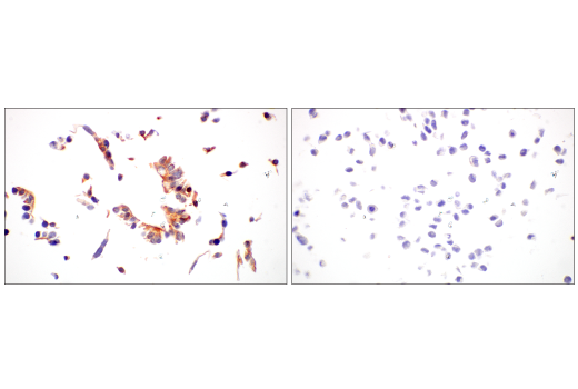Immunohistochemistry Image 7: GUCY2C (E6I2U) Rabbit mAb (BSA and Azide Free)