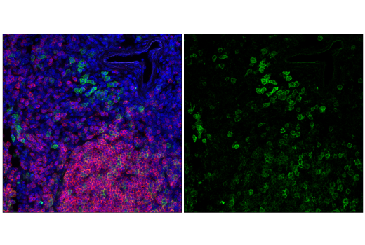 Immunofluorescence Image 1: TACI/TNFRSF13B/CD267 (E3P6X) Rabbit mAb