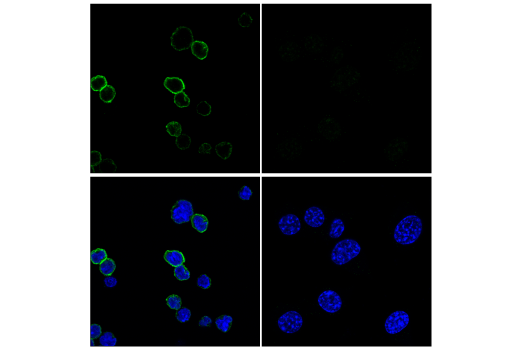 Immunofluorescence Image 2: TACI/TNFRSF13B/CD267 (E3P6X) Rabbit mAb