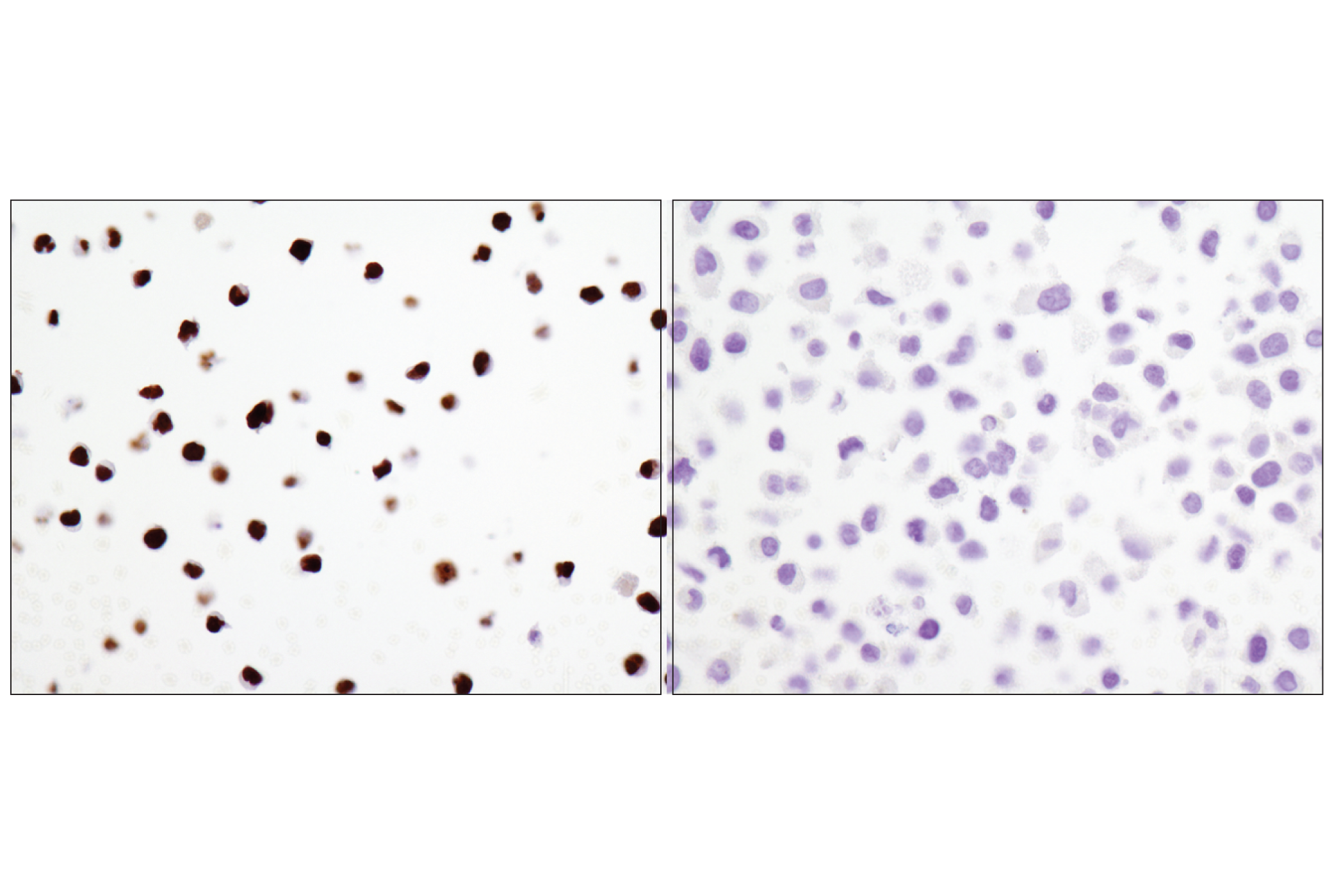 Immunohistochemistry Image 5: PAX5 (D7H5X) XP® Rabbit mAb (BSA and Azide Free)