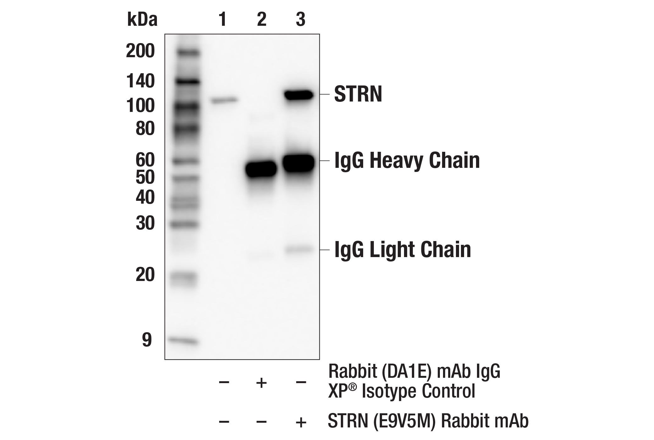 Immunoprecipitation Image 1: STRN (E9V5M) Rabbit mAb