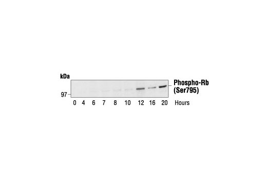 Western Blotting Image 1: Phospho-Rb (Ser795) Antibody
